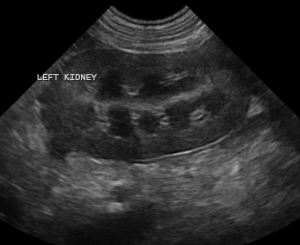 An ultrasound of a pet's kidneys